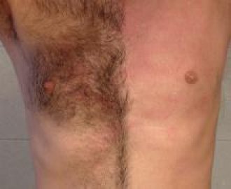 depilacion intima para caballeros